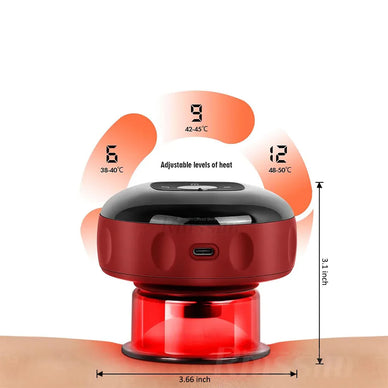 Cupping just went hi-tech