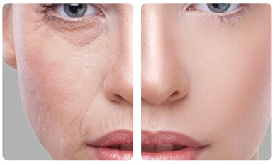 Revitalize Your Skin with Collagen Power